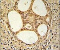 PRUNE Antibody in Immunohistochemistry (IHC)