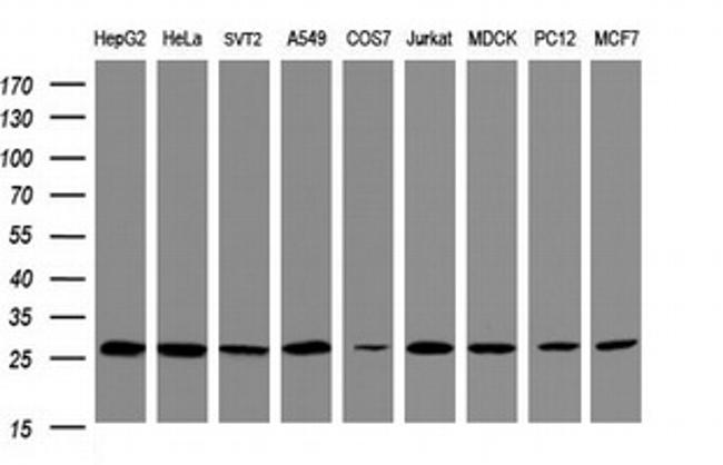 PSMA2 Antibody in Western Blot (WB)