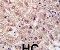 PSMA5 Antibody in Immunohistochemistry (IHC)