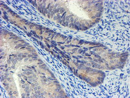 PSMA6 Antibody in Immunohistochemistry (Paraffin) (IHC (P))