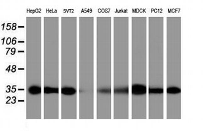PSMA6 Antibody in Western Blot (WB)