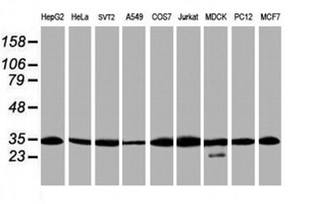 PSMA6 Antibody in Western Blot (WB)