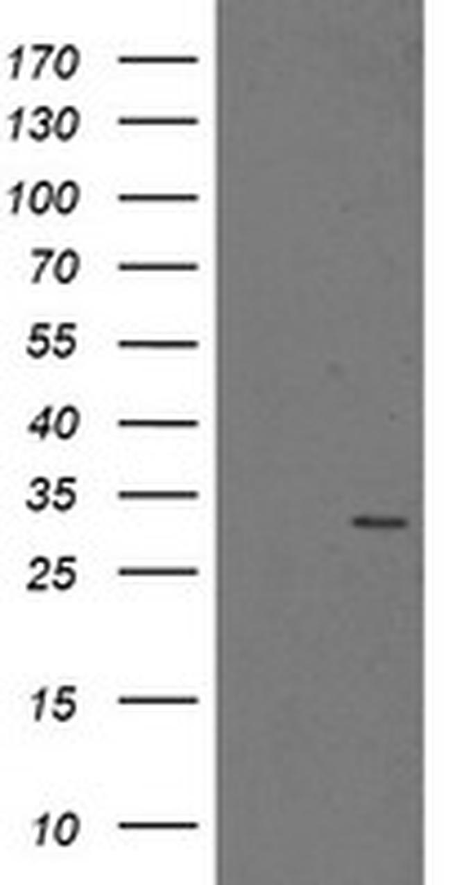 PSMA6 Antibody in Western Blot (WB)