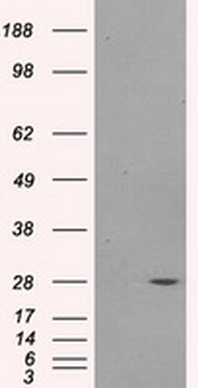 PSMA7 Antibody in Western Blot (WB)