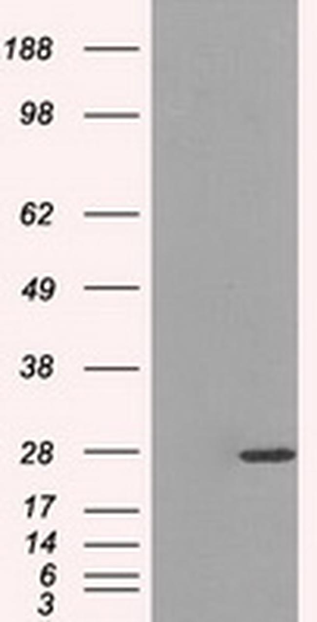 PSMA7 Antibody in Western Blot (WB)