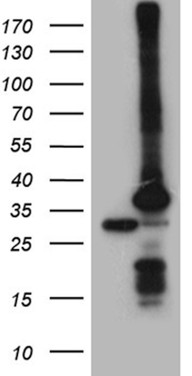 PSMA7 Antibody in Western Blot (WB)