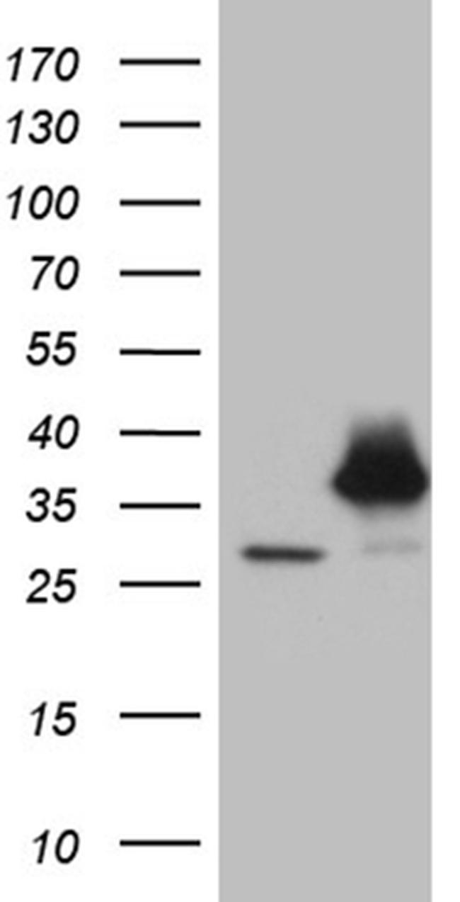 PSMA7 Antibody in Western Blot (WB)
