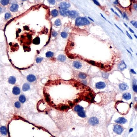 PSMA Antibody in Immunohistochemistry (Paraffin) (IHC (P))