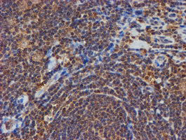 PSMB9 Antibody in Immunohistochemistry (Paraffin) (IHC (P))