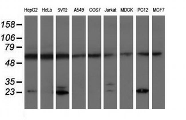 PSMB9 Antibody in Western Blot (WB)