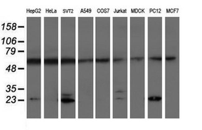 PSMB9 Antibody in Western Blot (WB)