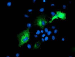 PSMD2 Antibody in Immunocytochemistry (ICC/IF)