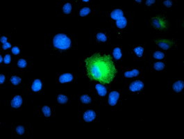 PSMD2 Antibody in Immunocytochemistry (ICC/IF)