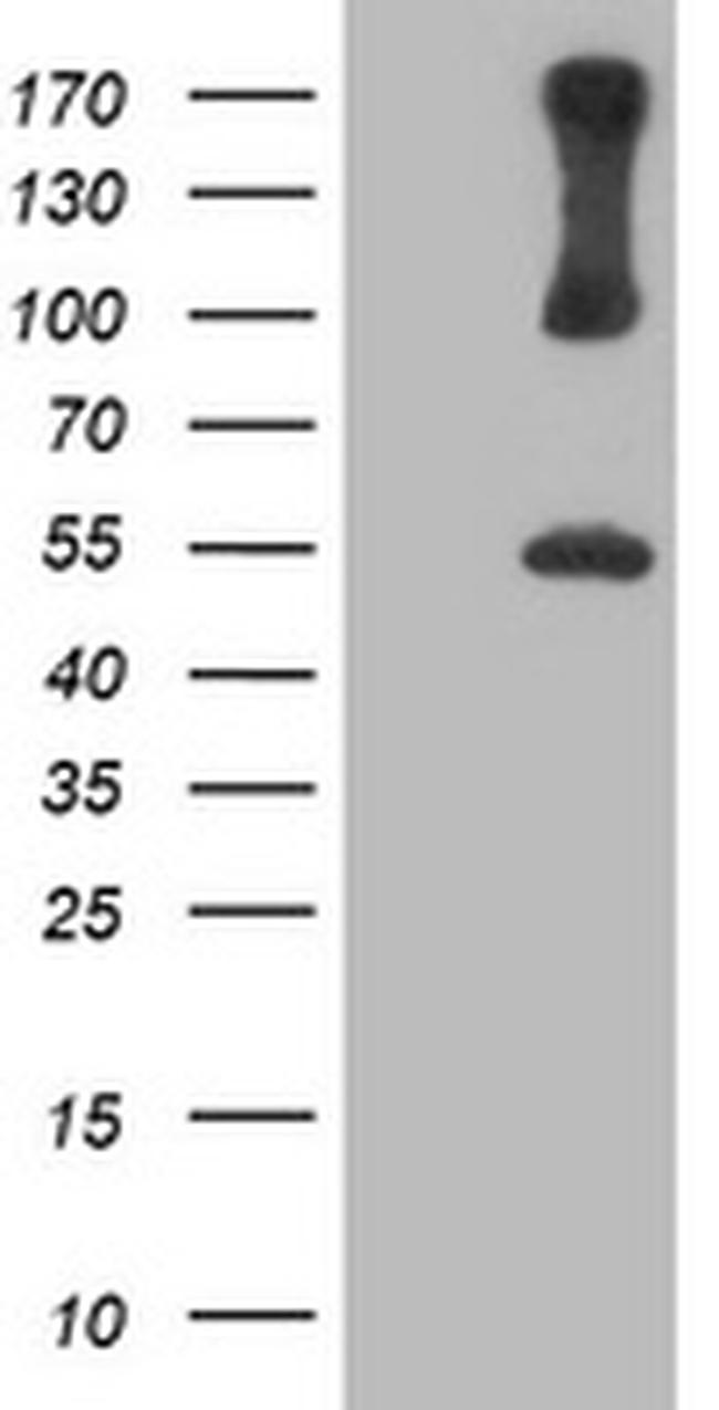 PSMD2 Antibody in Western Blot (WB)