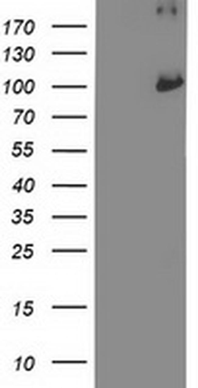 PSMD2 Antibody in Western Blot (WB)