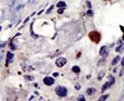 PSMD4 Antibody in Immunohistochemistry (IHC)