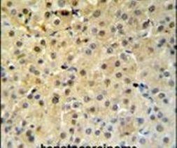 PSME1 Antibody in Immunohistochemistry (IHC)