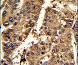 PSME2 Antibody in Immunohistochemistry (IHC)