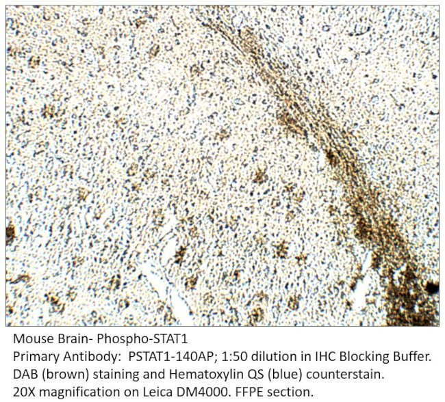 Phospho-STAT1 (Ser727) Antibody in Immunohistochemistry (IHC)