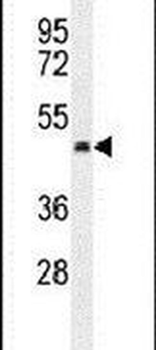PTCD2 Antibody in Western Blot (WB)
