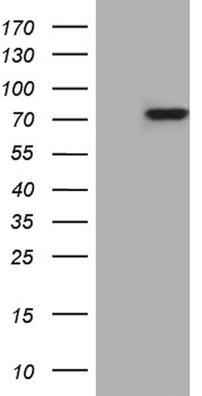 PTCD3 Antibody in Western Blot (WB)