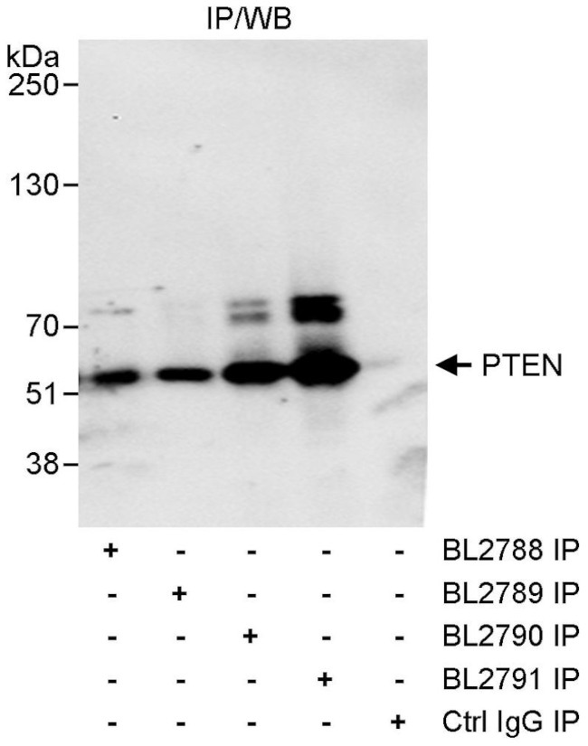 PTEN Antibody in Immunoprecipitation (IP)
