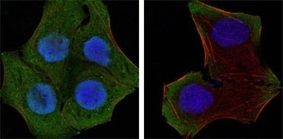 PTEN Antibody in Immunocytochemistry (ICC/IF)