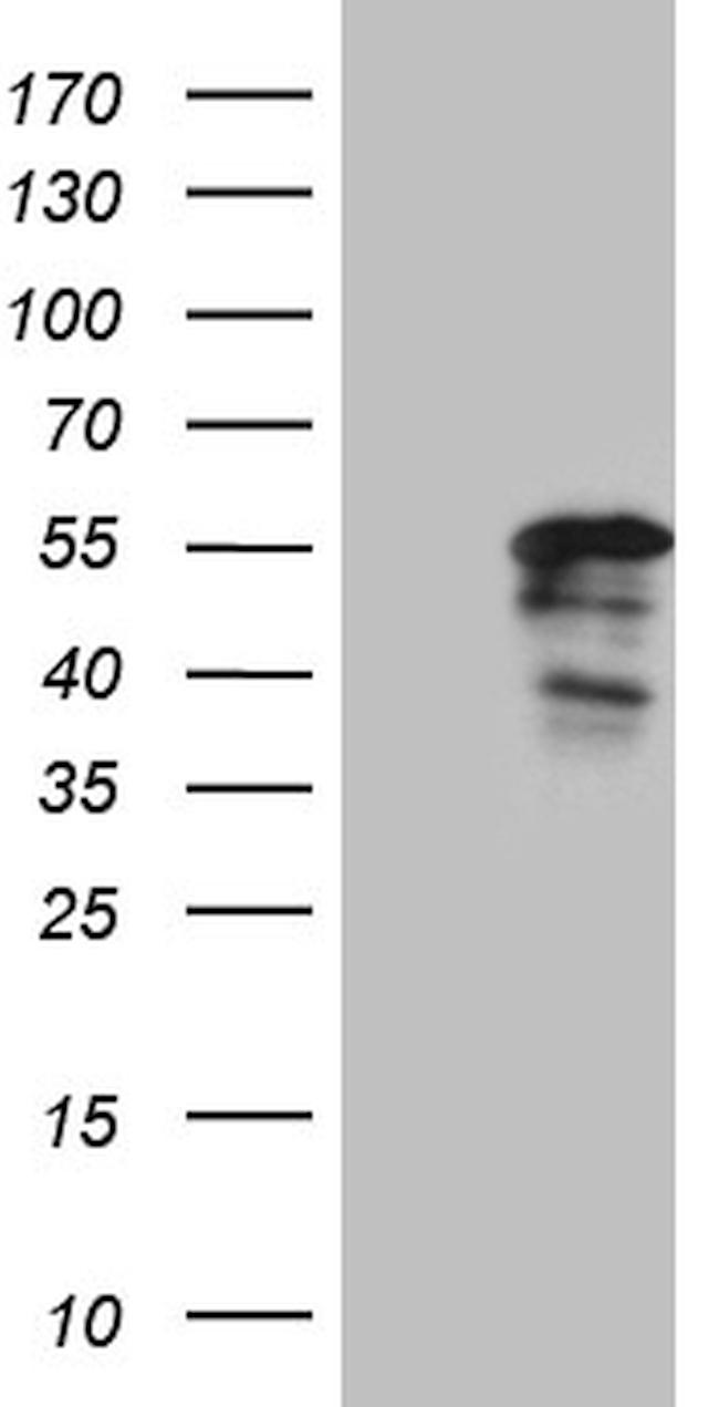 PTF1A Antibody in Western Blot (WB)