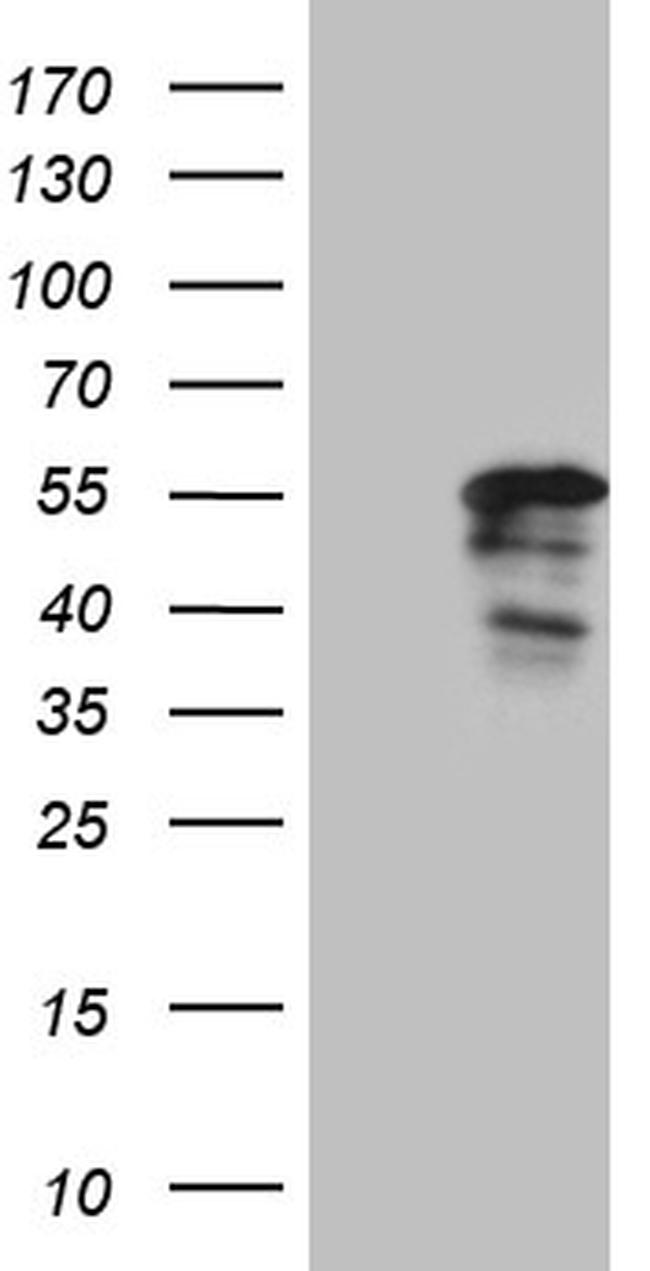 PTF1A Antibody in Western Blot (WB)