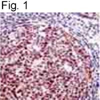DP1 Antibody in Immunohistochemistry (IHC)