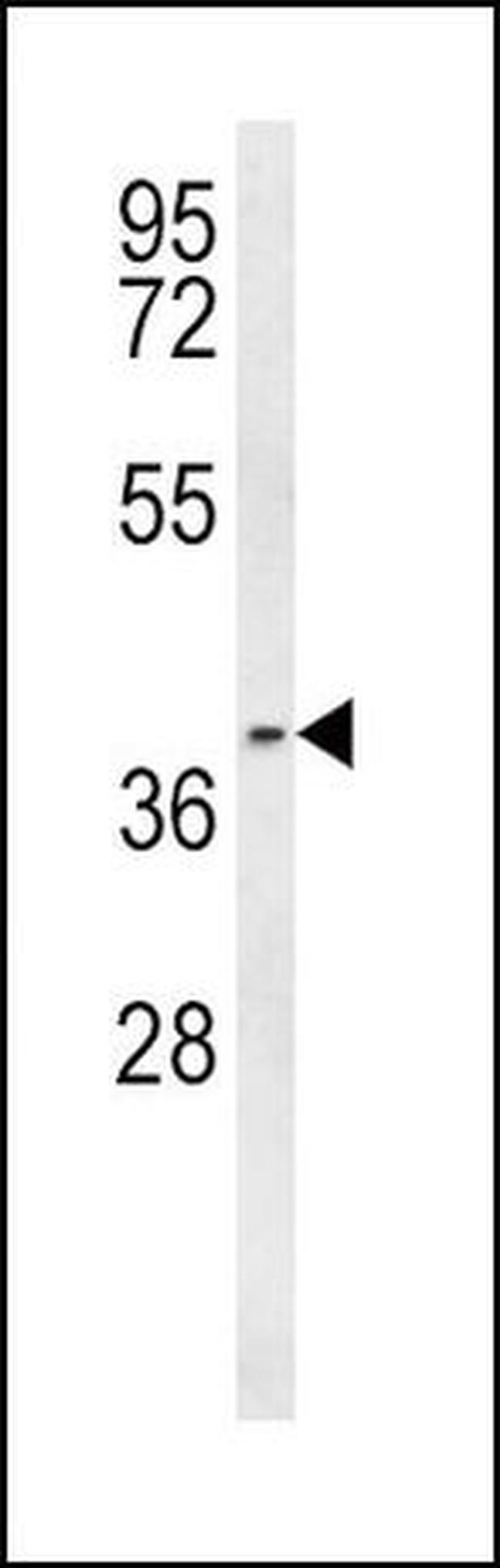 PTGER3 Antibody in Western Blot (WB)