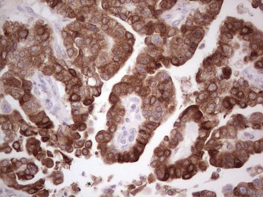 PTGS2 Monoclonal Antibody (OTI5F12), TrueMAB™ | Invitrogen (TA805286)