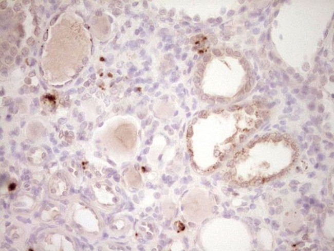 PTGS2 Antibody in Immunohistochemistry (Paraffin) (IHC (P))