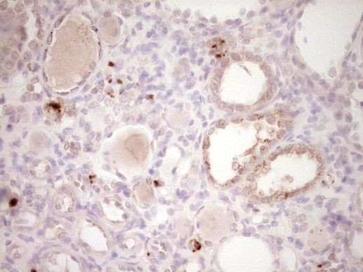 PTGS2 Antibody in Immunohistochemistry (Paraffin) (IHC (P))