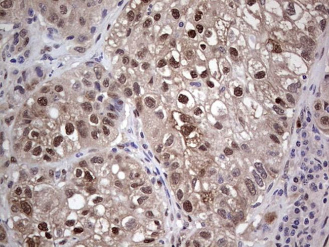 PTGS2 Antibody in Immunohistochemistry (Paraffin) (IHC (P))