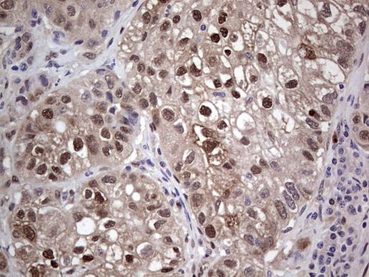 PTGS2 Antibody in Immunohistochemistry (Paraffin) (IHC (P))