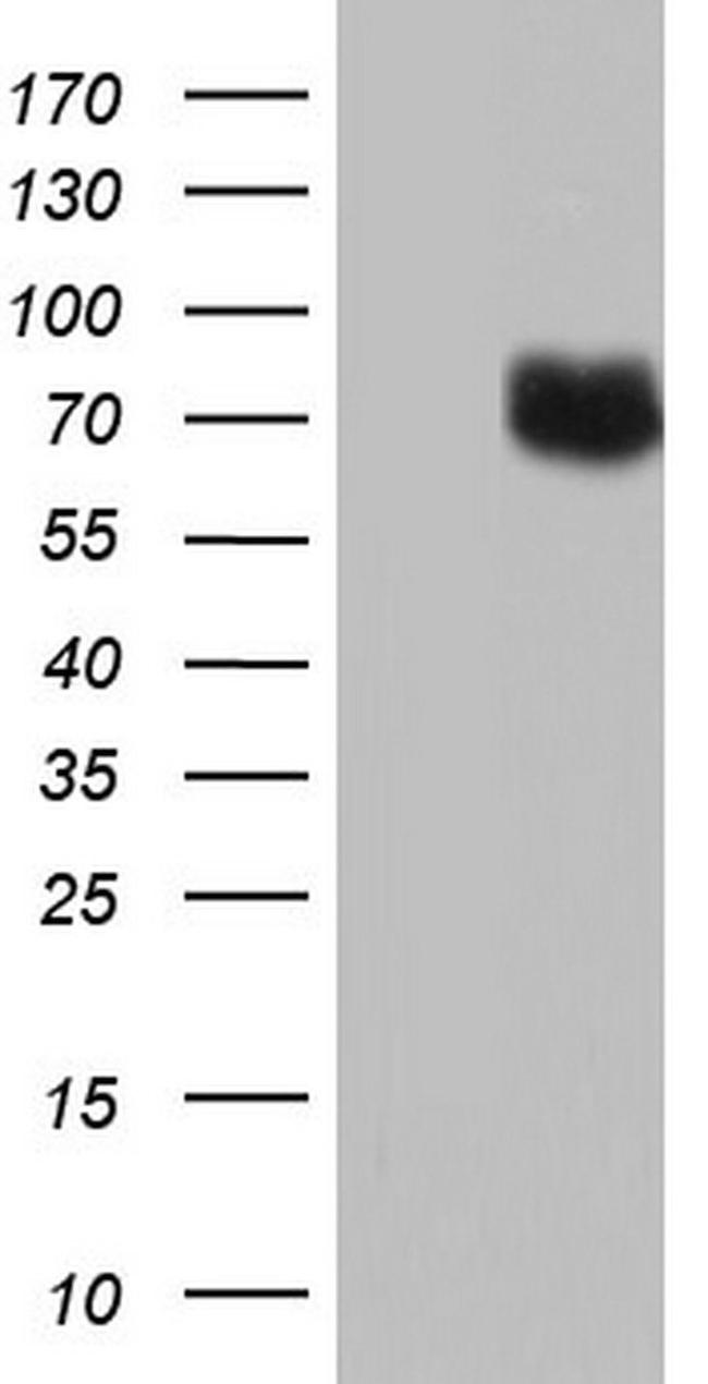 PTGS2 Antibody in Western Blot (WB)