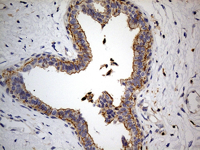 PTH Antibody in Immunohistochemistry (Paraffin) (IHC (P))