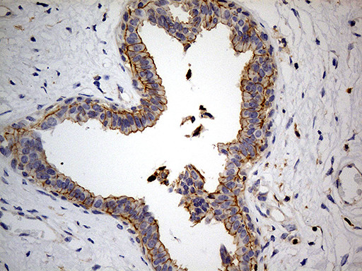 PTH Antibody in Immunohistochemistry (Paraffin) (IHC (P))