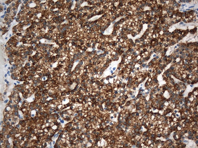 PTH Antibody in Immunohistochemistry (Paraffin) (IHC (P))