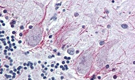 PTH2R Antibody in Immunohistochemistry (Paraffin) (IHC (P))