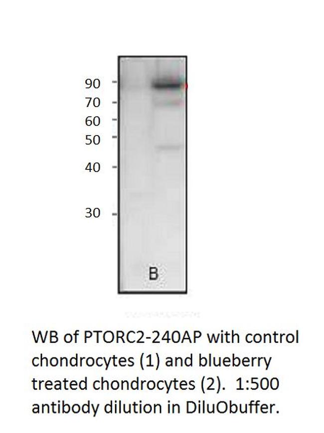 Phospho-TORC2 (Ser171) Antibody in Western Blot (WB)