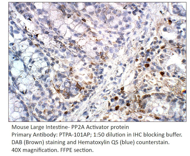 PP2A Activator protein Antibody in Immunohistochemistry (IHC)
