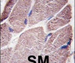 PTPN21 Antibody in Immunohistochemistry (IHC)