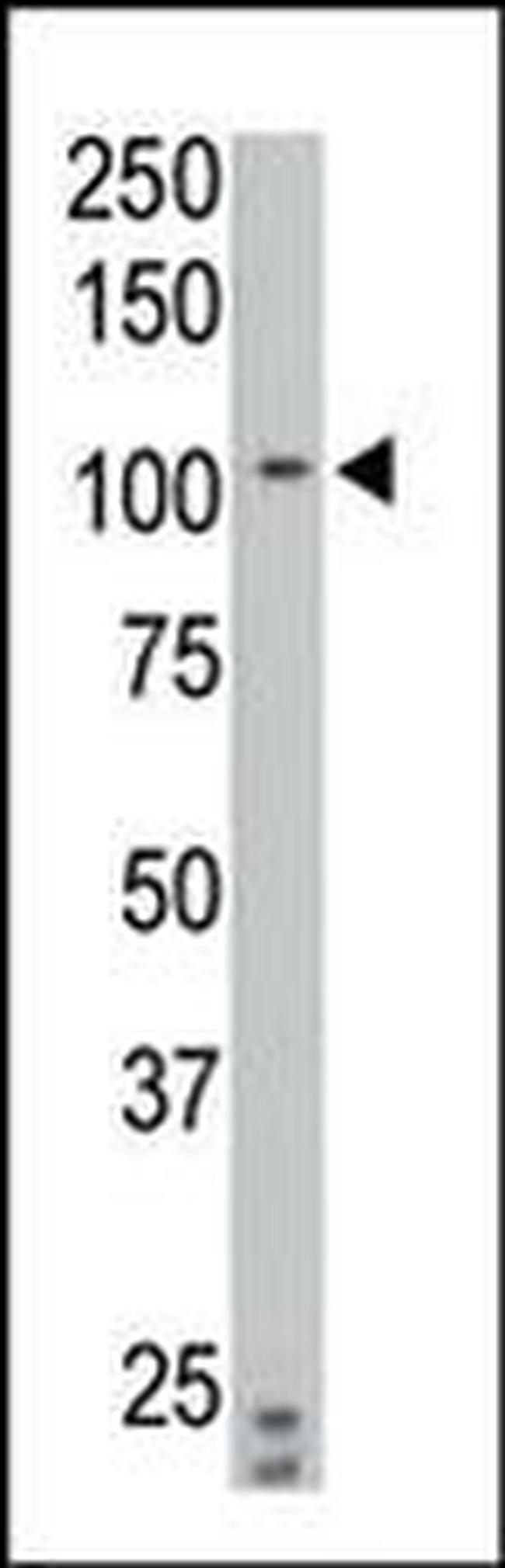 PTPRN2 Antibody in Western Blot (WB)