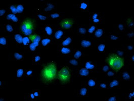 PTPN1 Antibody in Immunocytochemistry (ICC/IF)