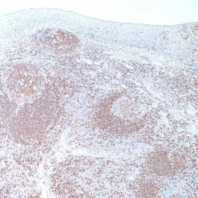 CD45RA Antibody in Immunohistochemistry (IHC)