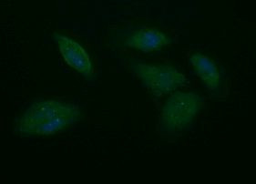 PTPRC Antibody in Immunocytochemistry (ICC/IF)