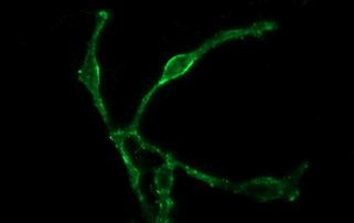 PTPRC Antibody in Immunocytochemistry (ICC/IF)