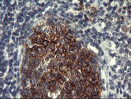 PTPRC Antibody in Immunohistochemistry (Paraffin) (IHC (P))